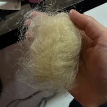 Zorunlu Satış Ve Bozuk Saç Boyası Nedeniyle Saç Dökülmesi Ve Deri Yanığı Şikayeti