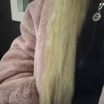 Zorla Satılan Saç Boyasıyla Deri Yanığı Ve Saç Hasarı Nedeniyle Tam İade Talebi