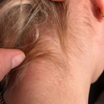 Zorla Satılan Saç Boyasıyla Deri Yanığı Ve Saç Hasarı Nedeniyle Tam İade Talebi