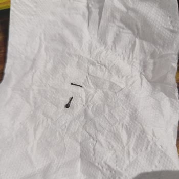 Künefe Paketi İçindeki Metal Parça Çocuğumun Sağlığını Tehlikeye Attı