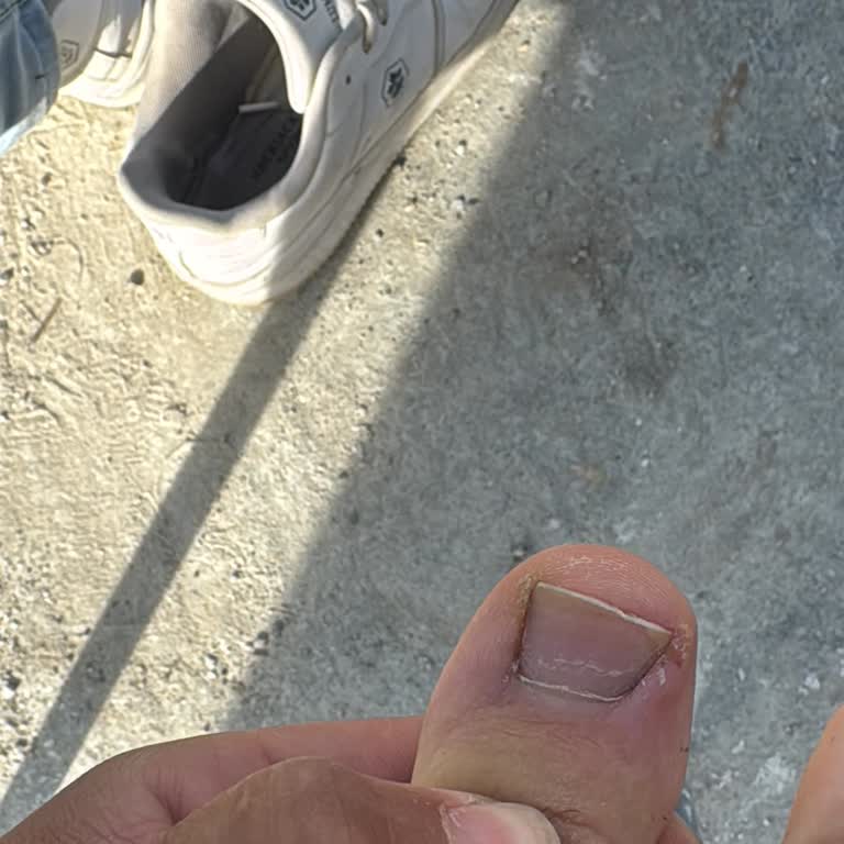 Ayakkabının Sağlık Problemi Ve İade Reddi