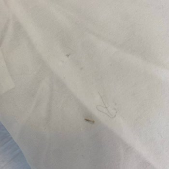 Ortopedi Servisinde Hijyen Eksikliği Ve Temizlik İhmaline Şikayet