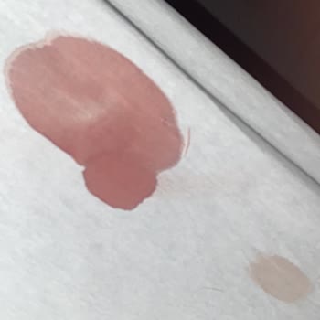 Ortopedi Servisinde Hijyen Eksikliği Ve Temizlik İhmaline Şikayet