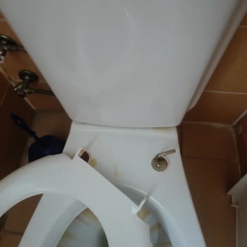 Gazi Yaşargil Eğitim Araştırma Hastanesi Hijyen Sorunu!
