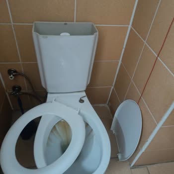 Gazi Yaşargil Eğitim Araştırma Hastanesi Hijyen Sorunu!