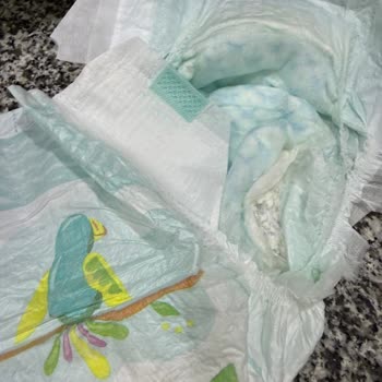 Prima Bebek Bezinde Kireç Benzeri Sert Parçacıklar Ve Sağlık Riski