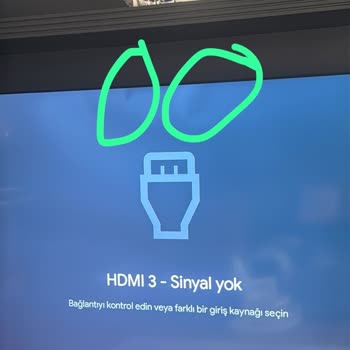 Hasarlı Televizyon İçin İade Ve Değişim Talebi Oyalama