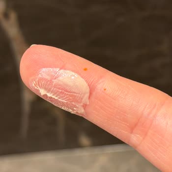 Ambalaj Kalitesindeki Sorun Nedeniyle Göz Kremi Kullanılamaz Ve İade Talebi