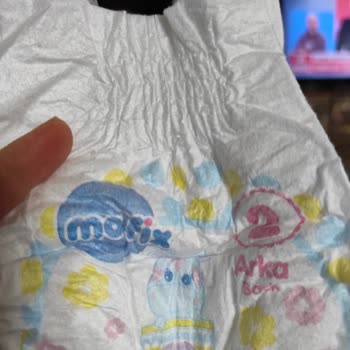 Molfix Bebek Bezinde Sırt Sızıntısı