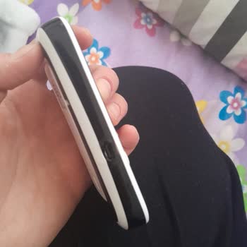 Şarj Girişi Erimiş Bebek İzleme Cihazı Güvenlik Riski Ve Garantiden Yanıtsızlık