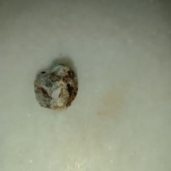 Metro Market Aro Dondurulmuş Patatesinde Yabancı Madde Tespiti