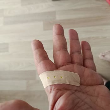 Kırık Parfüm Şişesi Nedeniyle El Kesildi, Hızlı Değişim Veya İade Talebi