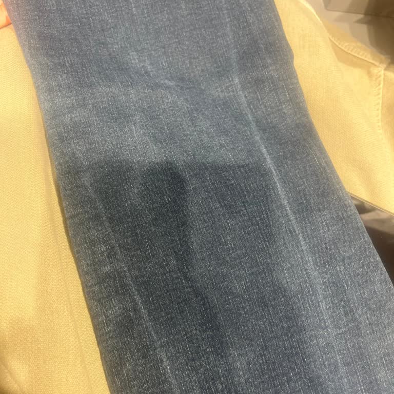 Mavi Jean Pantolonun Damar Atması Ve Değişim Talebi