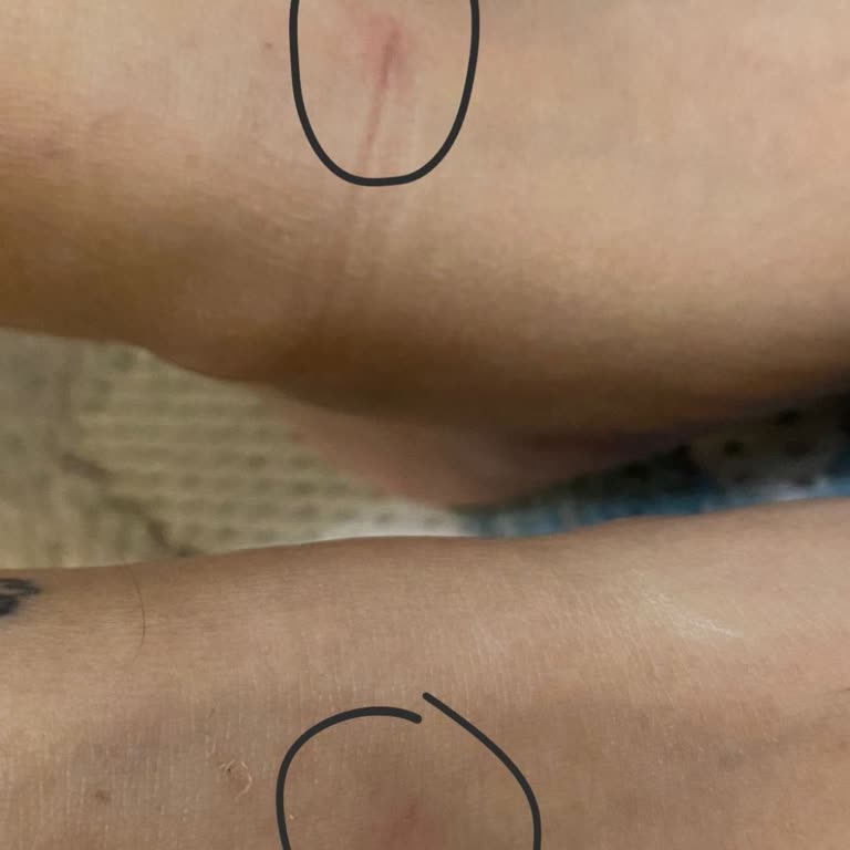 Ayak Vuran Sert Üst Kısmı Ayakkabının Değişim Talebi