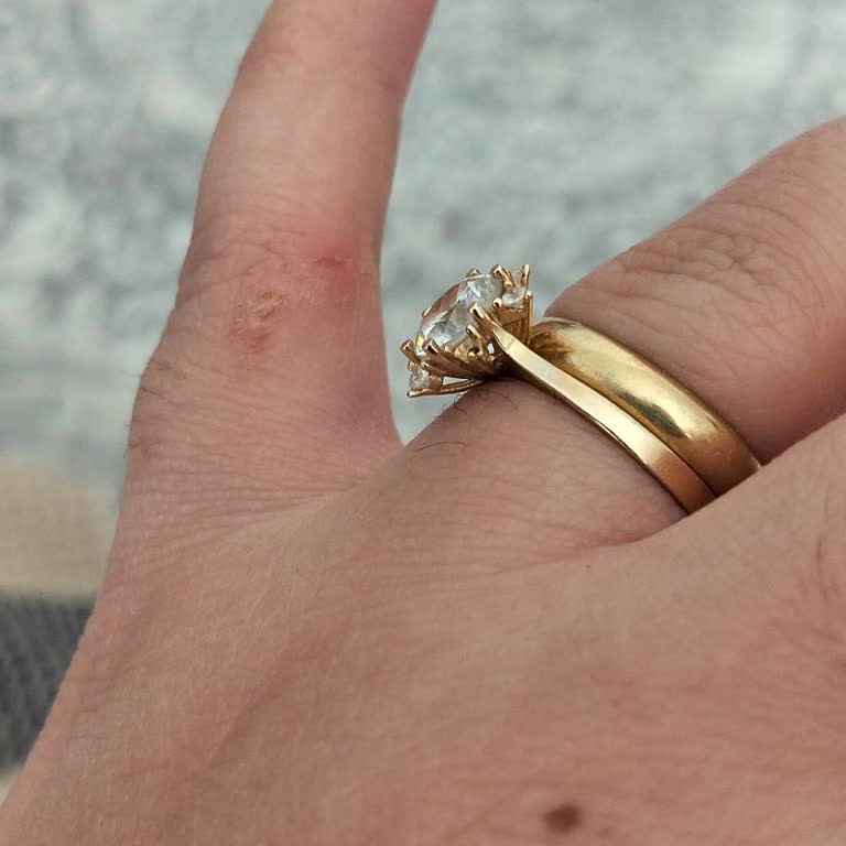 Aşırı Fiyat, Kalitesiz Yüzük Ve Güvensiz Hizmet Şikayeti