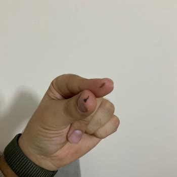 Ayranda Bulunan Siyah Yabancı Madde Ve Yetersiz Müşteri Hizmetleri