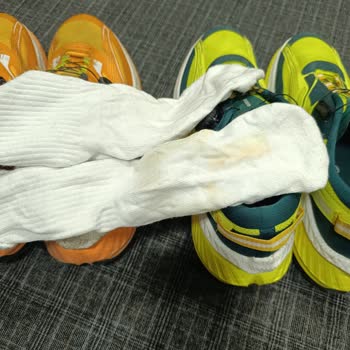 Ayakkabıların Boya Vermesi Ve Fiziksel İncelemeden Reddedilen Değişim Talebi