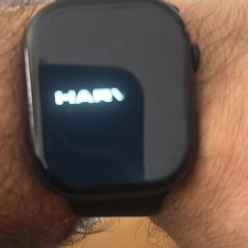 Harvox Watch 11+ Akıllı Saat Kapanıyor Ve Hemen Değişim İstiyorum
