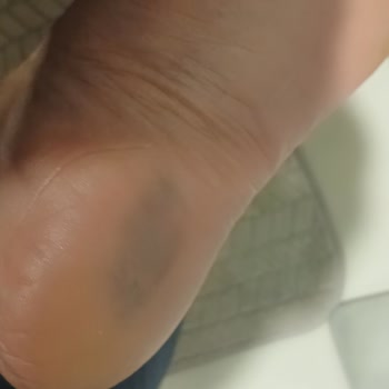 Sağlık Sorunu Yaratan Bot İadesi Reddedildi, Geri Dönüş Alınamadı