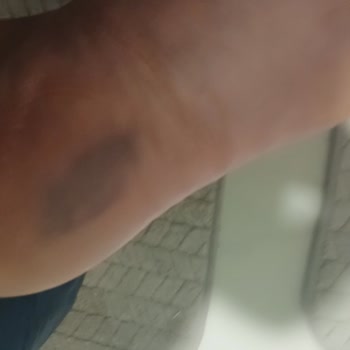 Sağlık Sorunu Yaratan Bot İadesi Reddedildi, Geri Dönüş Alınamadı