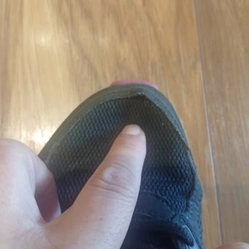 Skechers Ayakkabımın Dikiş Açılması Ve Red Açıklamasının Şeffaf Olmaması