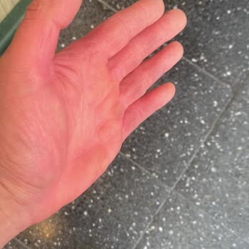 Aracımda Renk Bırakan Temizleyici Ürün İçin Tam İade Talebi