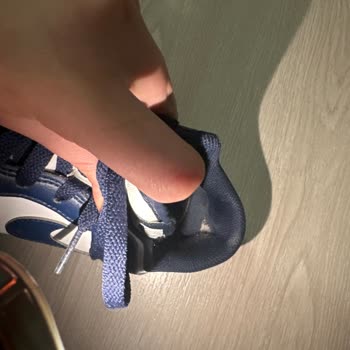 Nike Ürünlerinde Açılma, Garanti Redi Ve Kalite Sorunu