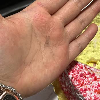 Frambuazlı Pastada Cam Benzeri Keskin Cisim Bulunması Ve Acil Soruşturma Talebi