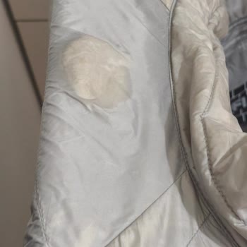 Montun Arkasındaki Tüy Kaybı Nedeniyle İade Talebi