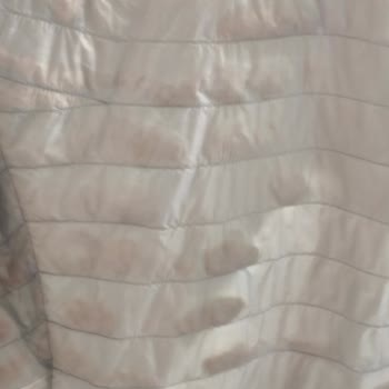 Montun Arkasındaki Tüy Kaybı Nedeniyle İade Talebi