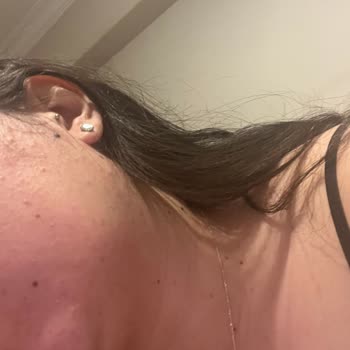 Caudalie Vinoperfect Ürünü Cilt Reaksiyonu Yarattı Sağlık Bakanlığı İncelemesi Talep Ediliyor