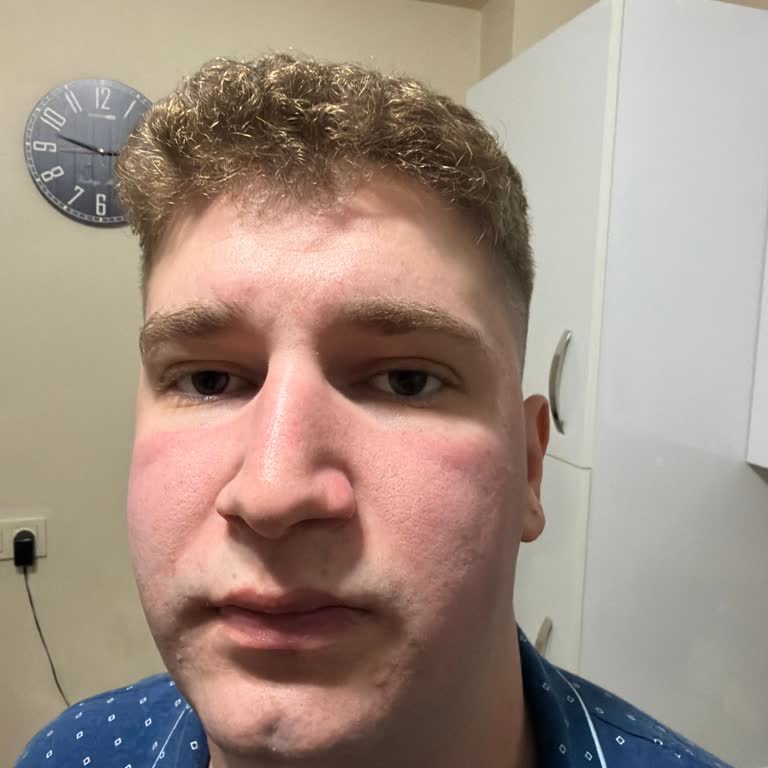 Pure Menthe Yüz Yıkama Jelinde Cilt Yanması Ve İade Talebi