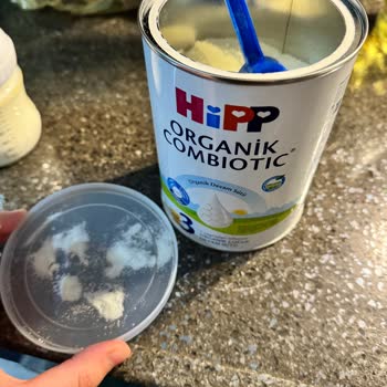 Bebek Mamasındaki Sert Yabancı Cisim Nedeniyle Endişe Ve İade Talebi