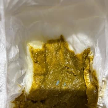 Bebek Kıyafetindeki Boya Parçası Sağlık Tehlikesi Ve Mağaza Sorumluluk Reddi