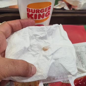 Burger King Tavuk Burgerinde Kemik Parçası Şikayeti