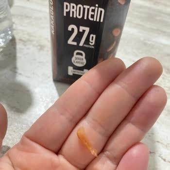 Sek Protein Sütünde Yabancı Cisim Bulunması Ve Güven Kaybı