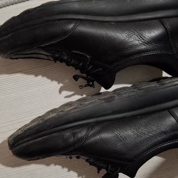 Topuk Dikenine Destek Bekleyen Müşterinin Konforsuz Mağduriyeti