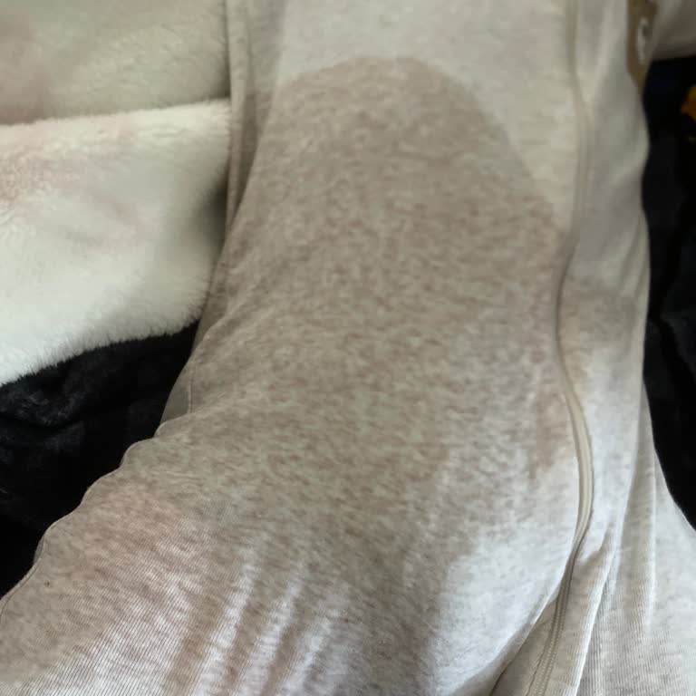 Migros’tan Aldığım Molfix Bebek Bezleri Sürekli Sızdırma Ve Şiddetli Pişik Oluşturuyor