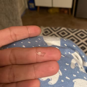 Beyoğlu Çikolata Yabancı Madde Çıktı Dişime Zarar Verdi