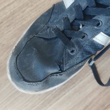 Kısa Sürede Yırtılan Çocuk Ayakkabısı Nedeniyle Mağduriyet Ve Değişim Talebi