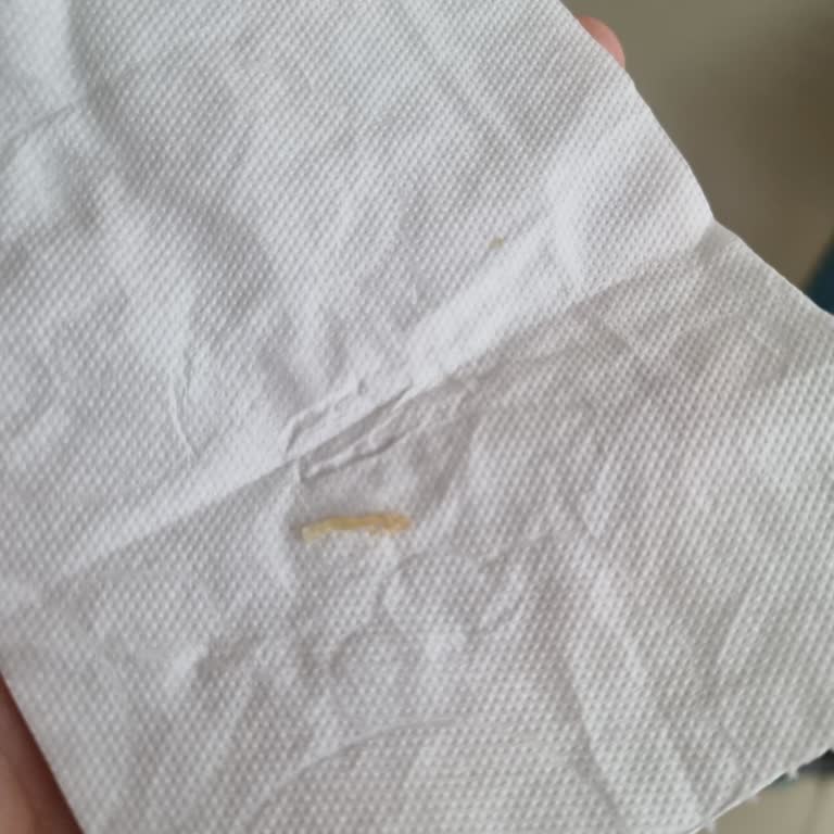 A101 Kardelen Şubesinde Açık Ekmekte İnsan Tırnağı Çıktı: Hijyen İhmaline Karşı Şikayet