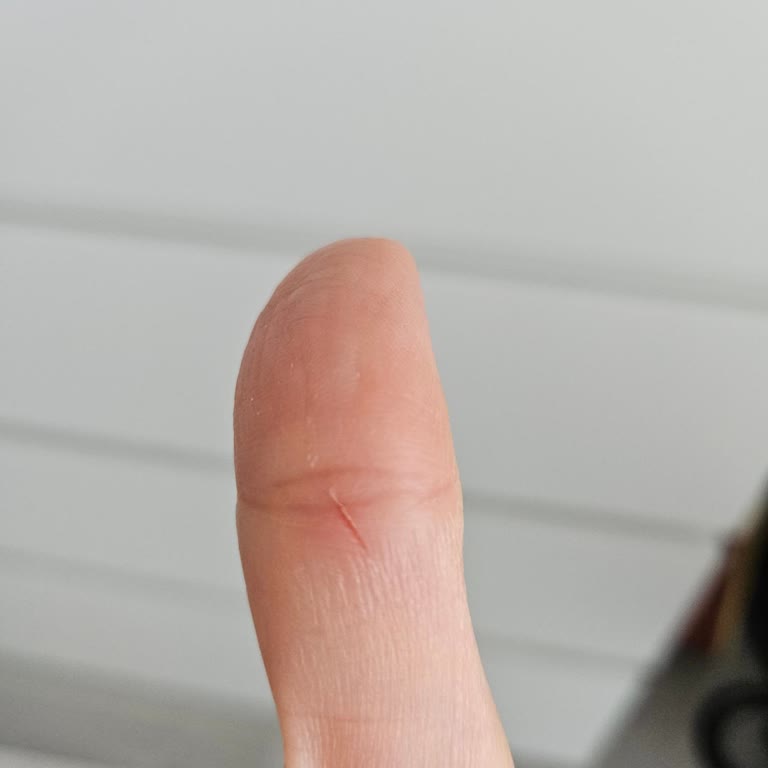 Tezgah Üstü Kesme Tahtasında Keskin Kenarlar Yarattığı Güvenlik Sorunu