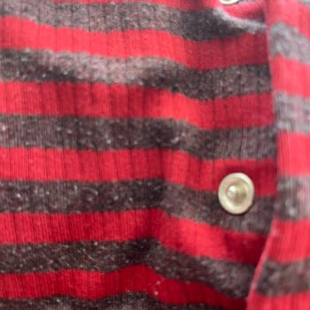 Hello Baby Bebek Tulumlarında Kalite Sorunu: Kısa Sürede Tüylendi