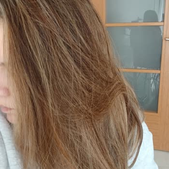 Saçlarım Mahvoldu, Kuaförün Kötü Hizmeti Ve 32.000 TL Ücret