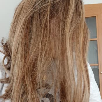 Saçlarım Mahvoldu, Kuaförün Kötü Hizmeti Ve 32.000 TL Ücret