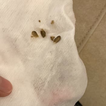 Kırmızı Mercimekte Taş Benzeri Yabancı Madde Bulunması