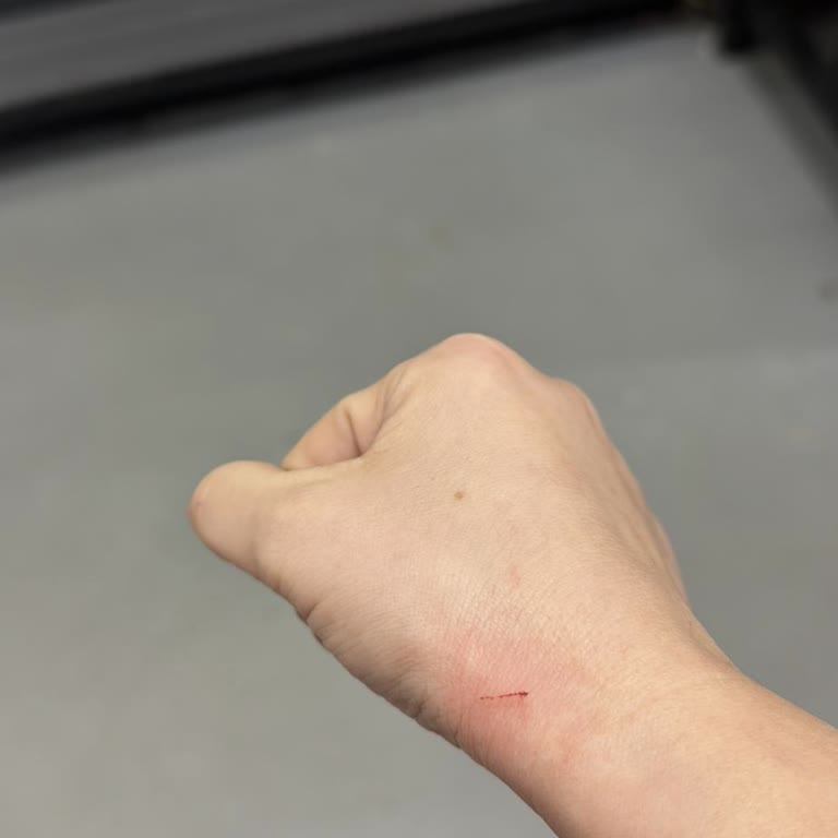 Raf Çivileri İş Güvenliğini Tehlikeye Atıyor, Yanıt Bekleniyor