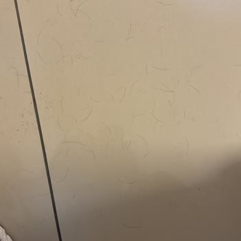 Uraw Mavi Sprey Sonrası Aşırı Saç Dökülmesi Ve İade Garantisinin Reddi