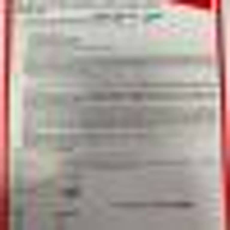 3 Yıllık Garanti Ve Ek Pakete Rağmen Batarya Ücretli Değişimi Kabul Edilemez