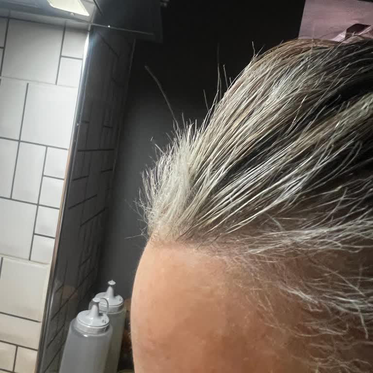 Röfle İşleminde Ön Saç Yanması Ve Kuaförün Sorumluluk Reddi